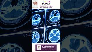 How Do Doctors Diagnose Brain Bleeding? | Expert Advice from Dr. Praveen Ankathi #neurosurgeon