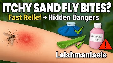🦟 How to Treat Sandfly Bites FAST | Home Remedies, Prevention & Leishmaniasis Explained!
