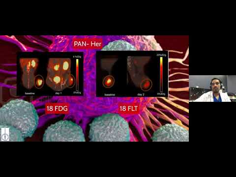 Vídeo: Predecir La Respuesta A Los Inhibidores Del Punto De Control En El Melanoma Más Allá De PD-L1 Y La Carga Mutacional
