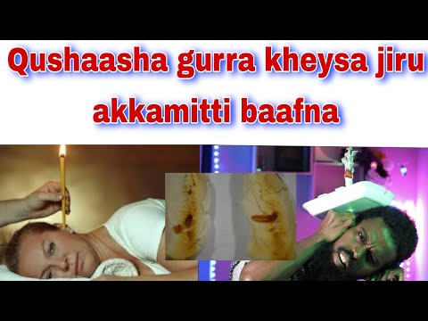Qushaasha Gurra Kheysa Akkamitti Baafna