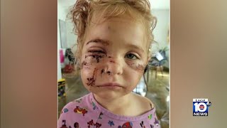 Mother blames Broward County after young daughter was attacked by dog