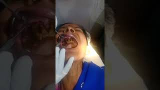poor oral hygiene: worms inside mouth; a case from Chhattisgarh screenshot 1