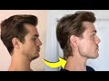 How i fixed my receding chin