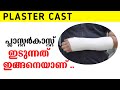 പ്ലാസ്റ്റർ ഇടുന്നത്  കണ്ടിട്ടുണ്ടോ ?|Plaster caster video