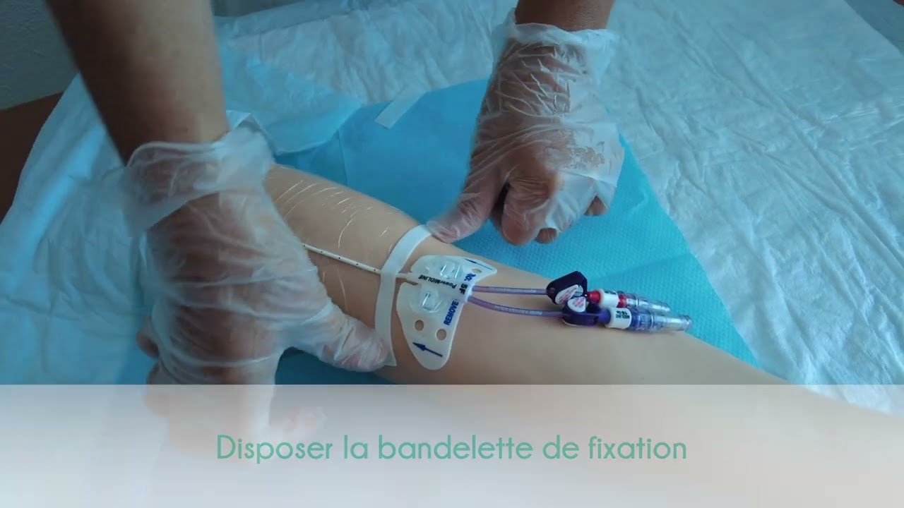 MIDLINE : réfection du pansement (formation hygiène)