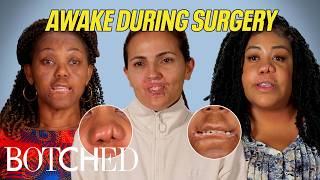 Wide Awake Under The Knife: Infected Lip Filler, Chemical Burn and More (Compilation) | Botched | E!