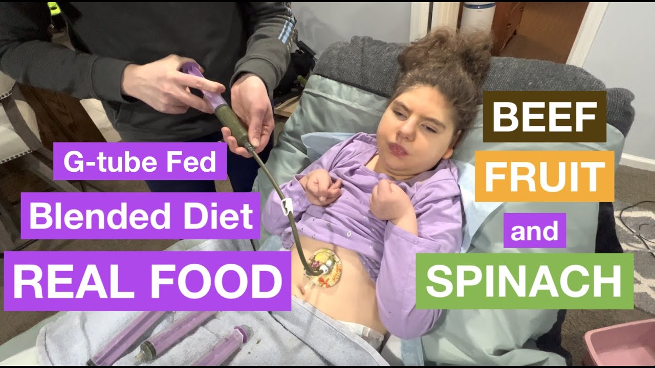 Blended Diet For G tube Beef Fruit And Spinach YouTube blended-diet-for-g-tube-beef-fruit-and-spinach-youtube