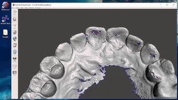 Basic Techniques with Dental CAD - Repairing Models, Making a Base, and Getting Ready for Printing