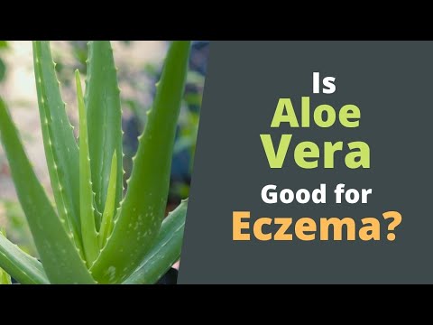 Is Aloe Vera Good for Eczema- Does the Gel Help with Eczema?