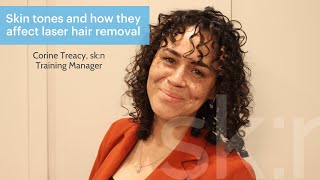 What is The Fitzpatrick Scale in regards to laser hair removal?