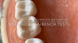 Evaluating Class II Composite Restoration