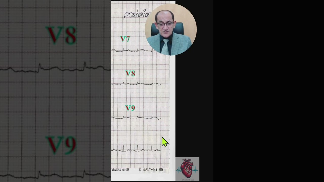 IHD WORKSHOPE  quiz 31 to 35  13