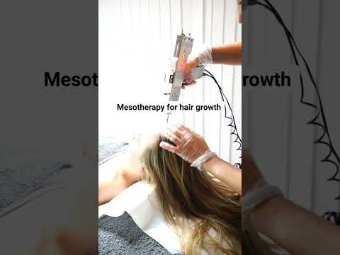 #mesotherapy #hair #hairloss