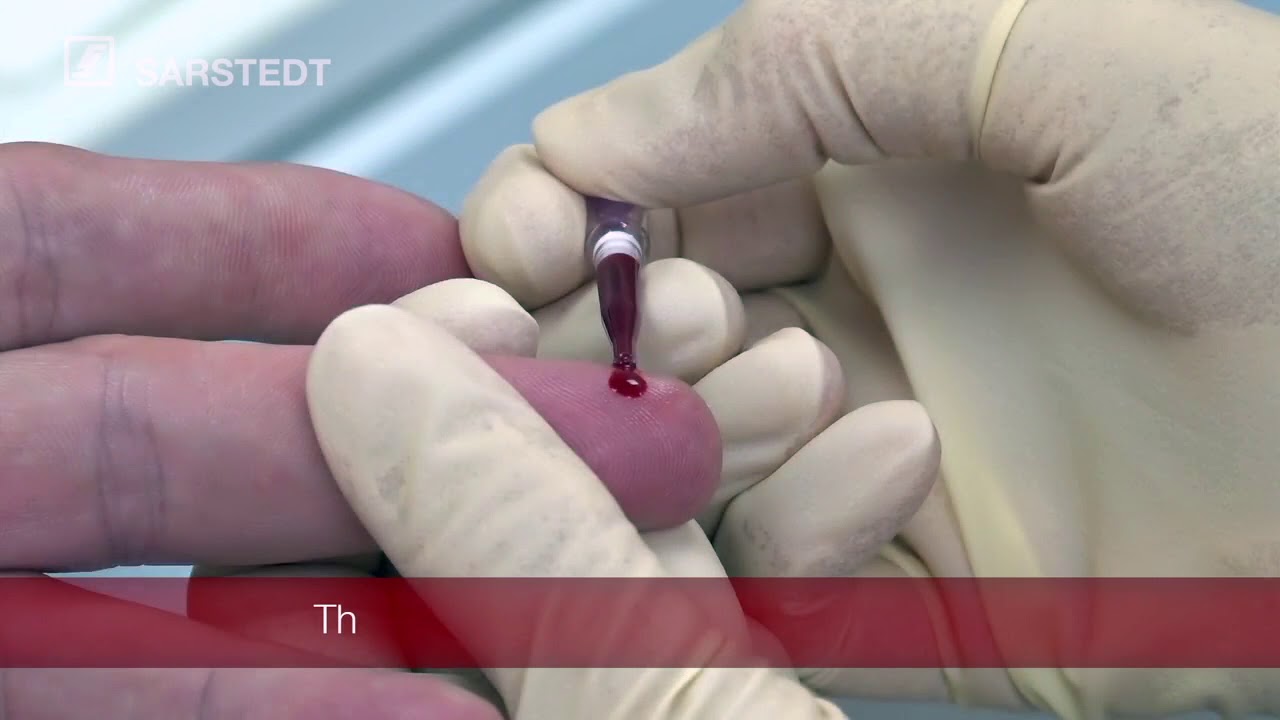 Sarstedt Minivette POCT