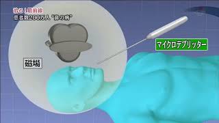 治る最前線「副鼻腔炎の最新治療」