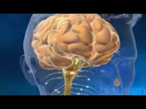 تحديد أحد الجينات المسببة لمرض الضمور العضلي