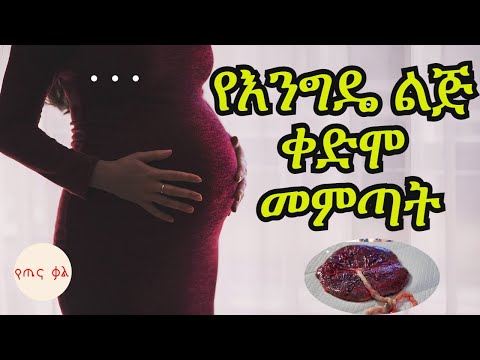 የእንግዴ ልጅ ቀድሞ መምጣት Ye Engde Lij Kedmo Memtat