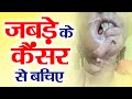 जबड़े के कैंसर से बचें | Prevent jaw cancer | Kitchen Therapy | Naturopathy |