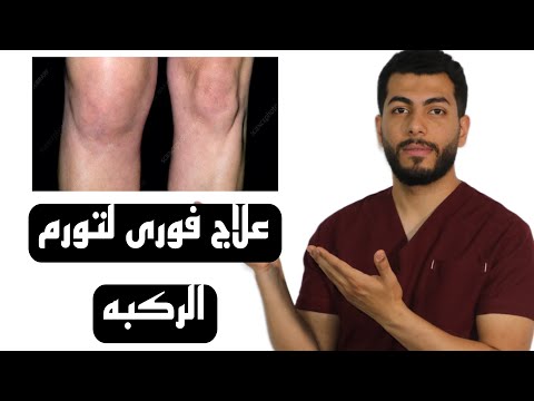 تورم الركبة الأسباب الخفية والعلاج الفعال لتخفيف الألم فورا