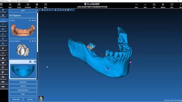 AI-supported teeth segmentation