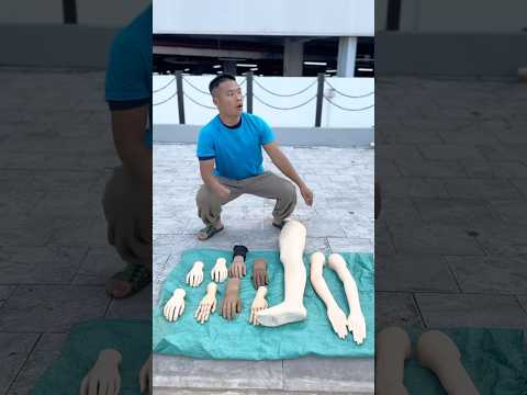 3 videos about prosthetic hands and feet.