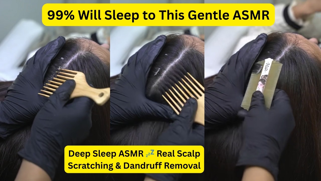 Deep Sleep ASMR 💤 Real Scalp Scratching & Dandruff Removal #29 #triggersforsleep @OceansASMR