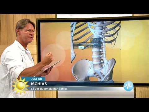 Dr Mikael - Så vet du om du har ischias - Nyhetsmorgon (TV4)