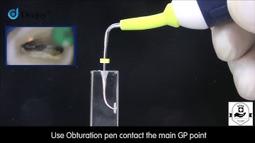 ifill Denjoy dental obturation system