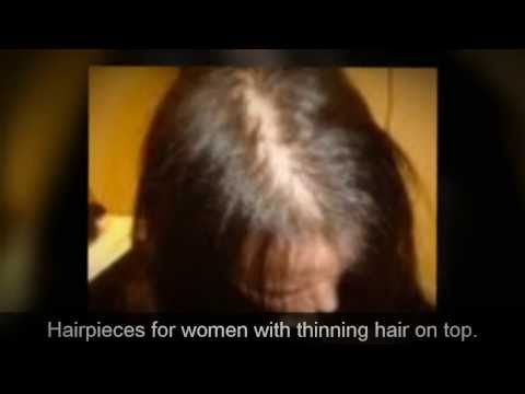 hair pieces for women's hair loss