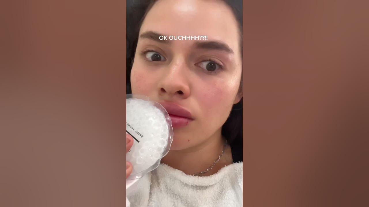 GETTING MY LIPS DISSOLVED shorts YouTube