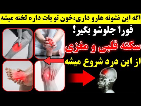 ۴ عادت روزانه که سکته و لخته خون میاره جراح عروق هشدار داد
