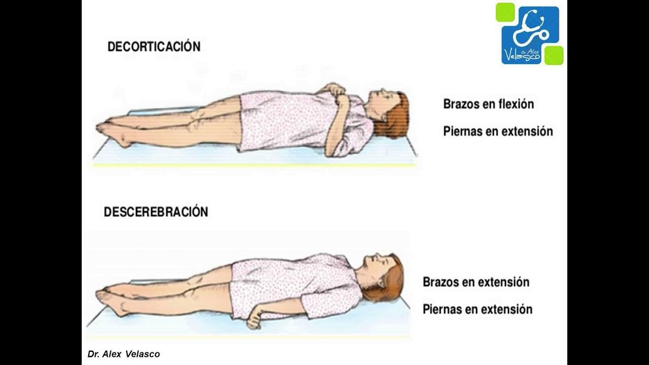 Flexion de piernas