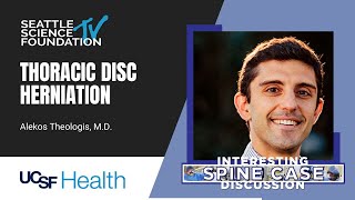 Thoracic Disc Herniation – Alekos Theologis, MD