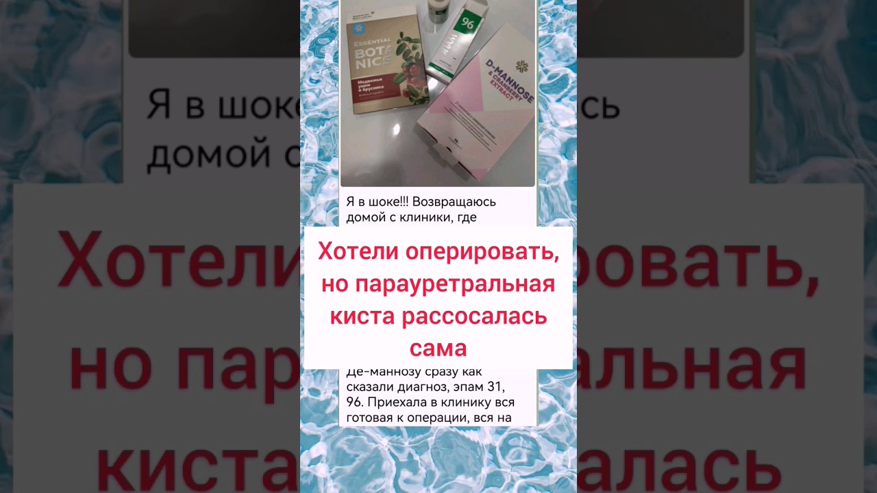 Как избавиться от парауретральной кисты