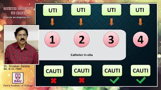 Catheter Associated UTI How to Diagnose