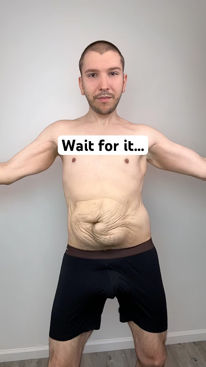 Skin Removal Reveal — 10 Million Views 😳