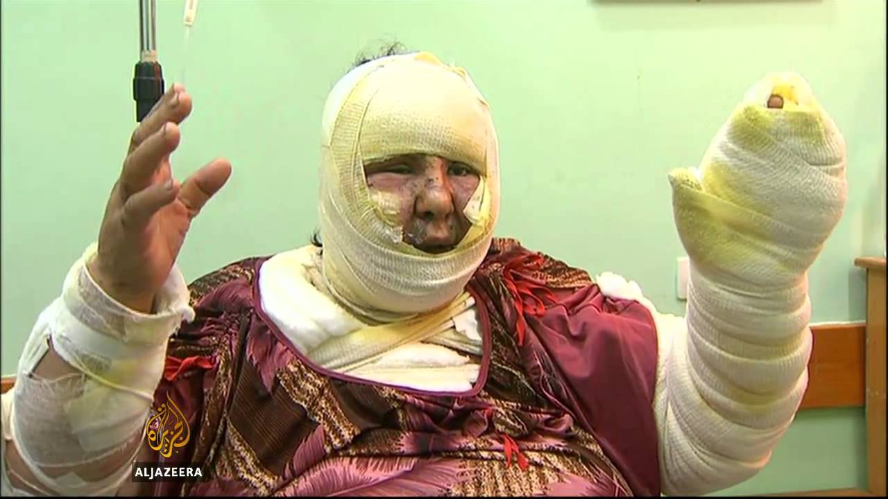 مستشفيات غزة مكتظة بالجرحى