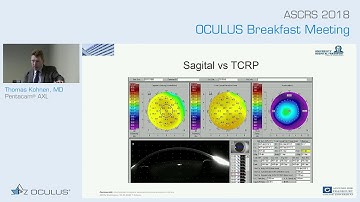 Prof. Thomas Kohnen: Pentacam® AXL