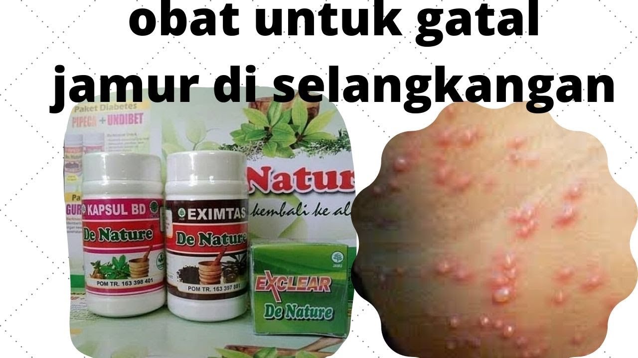 obat untuk gatal jamur di selangkangan 