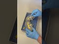 Kidney Dissection