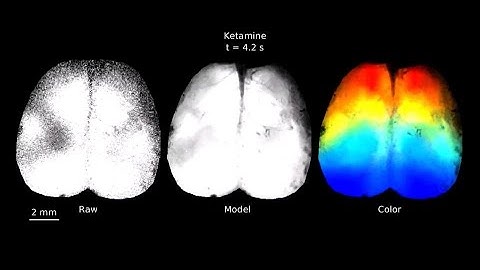 Audiovisualization of real-time neuroimaging data
