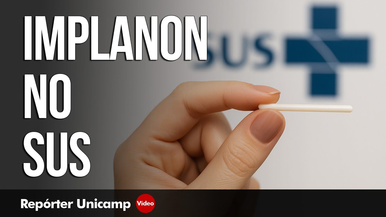 Contraceptivo Implanon vai ser oferecido pelo SUS