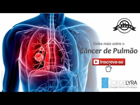 Vídeo: Câncer De Pulmão Glandular: Sintomas E Sinais. Prevenção E Tratamento Do Câncer Glandular De Pulmão