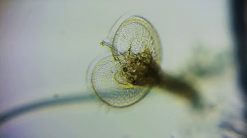 Microchasm: A Microscopic Opera