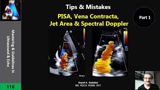 Tips & Mistakes: PISA, Vena Contracta ...