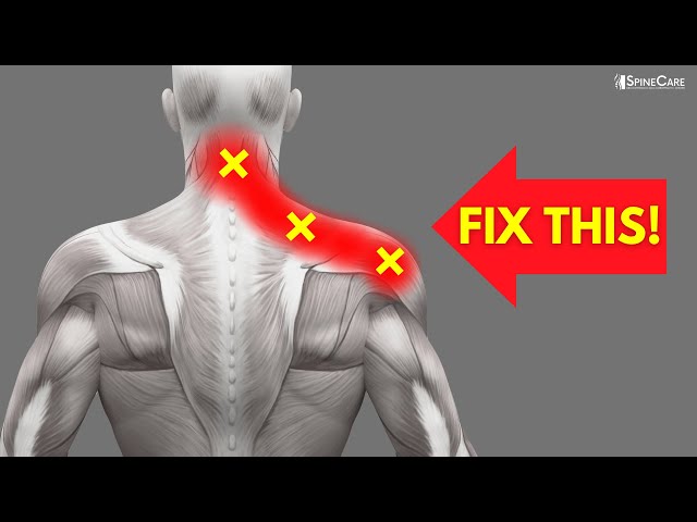 How to INSTANTLY Fix Pinched Nerve Pain in the Neck and Shoulders 