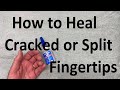 How to Heal Cracked or Split Fingertips.