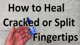 How to Heal Cracked or Split Fingertips.