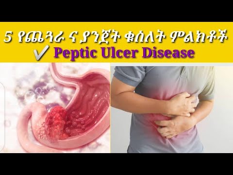 ✅ 5 የጨጓራ ና ያንጀት ቁስለት በሽታ ምልክቶች(5 symptom of peptic ulcer disease)