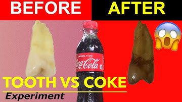 Tooth vs coke|Disgusting effect of cola on teeth|What does a cola do to our teeth|JamHomeScience Exp